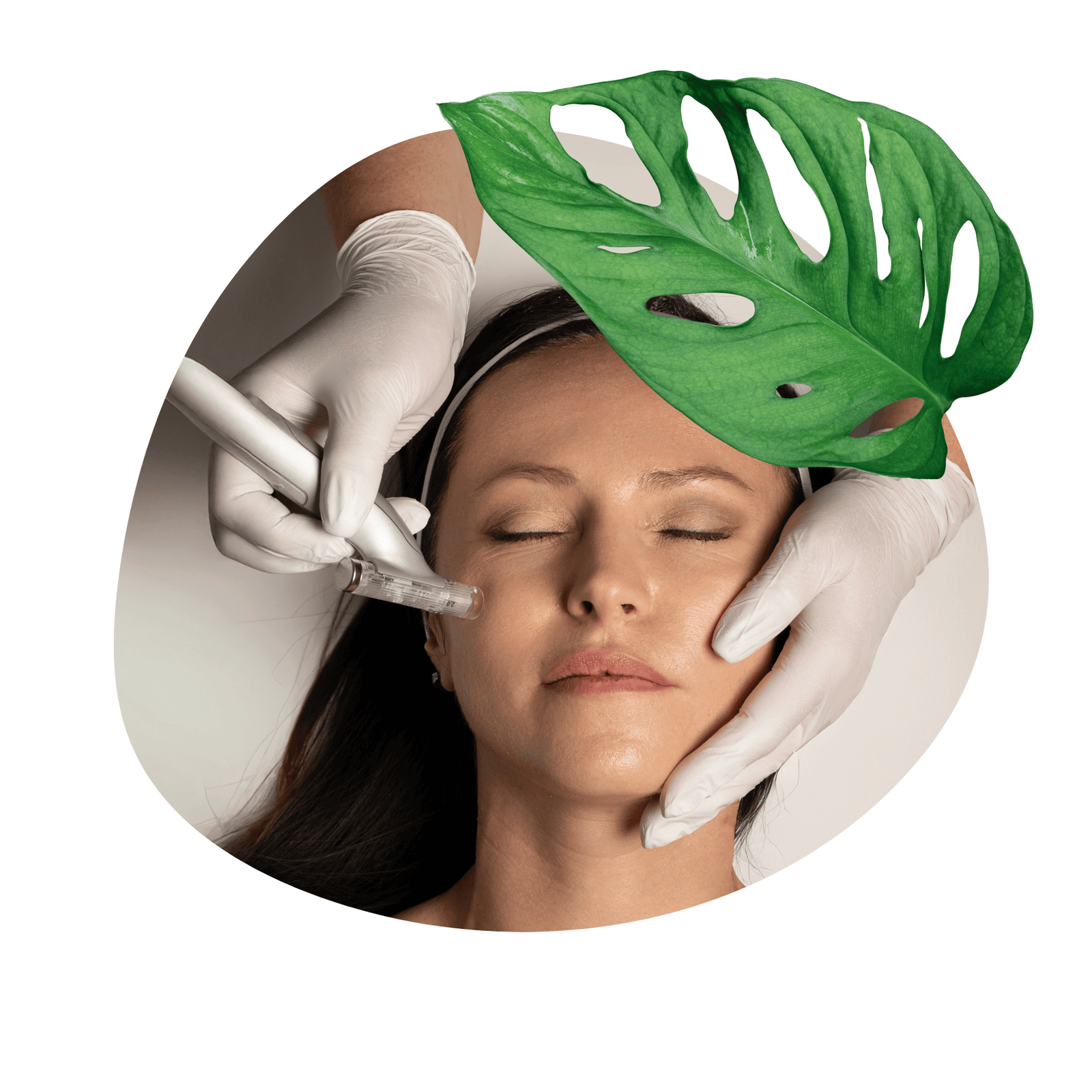 microneedling treatments in Edmonton at Malva Medical Aesthetic Centre