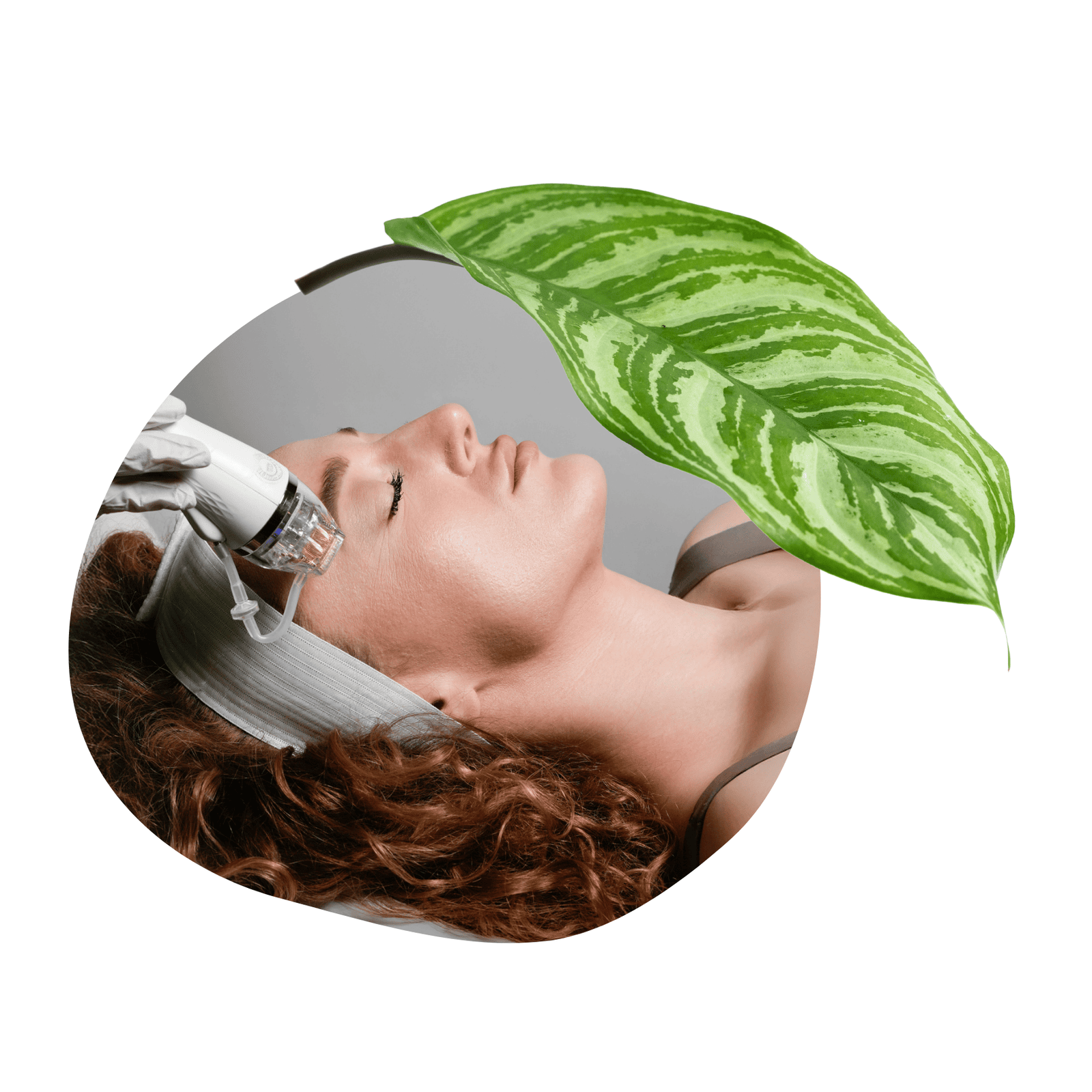 gold rf treatments in Edmonton at Malva Medical Aesthetic Centre gold rf treatments in Edmonton at Malva Medical Aesthetic Centre