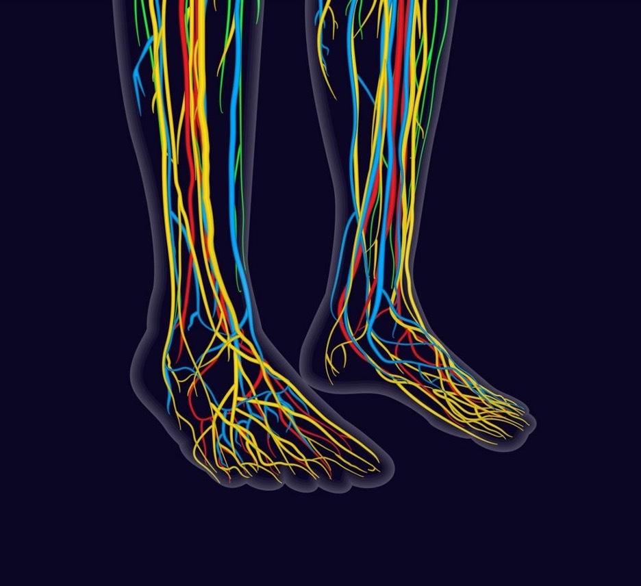 Medical illustration showing peripheral nerve pathways in the legs and feet affected by chemotherapy induced peripheral neuropathy