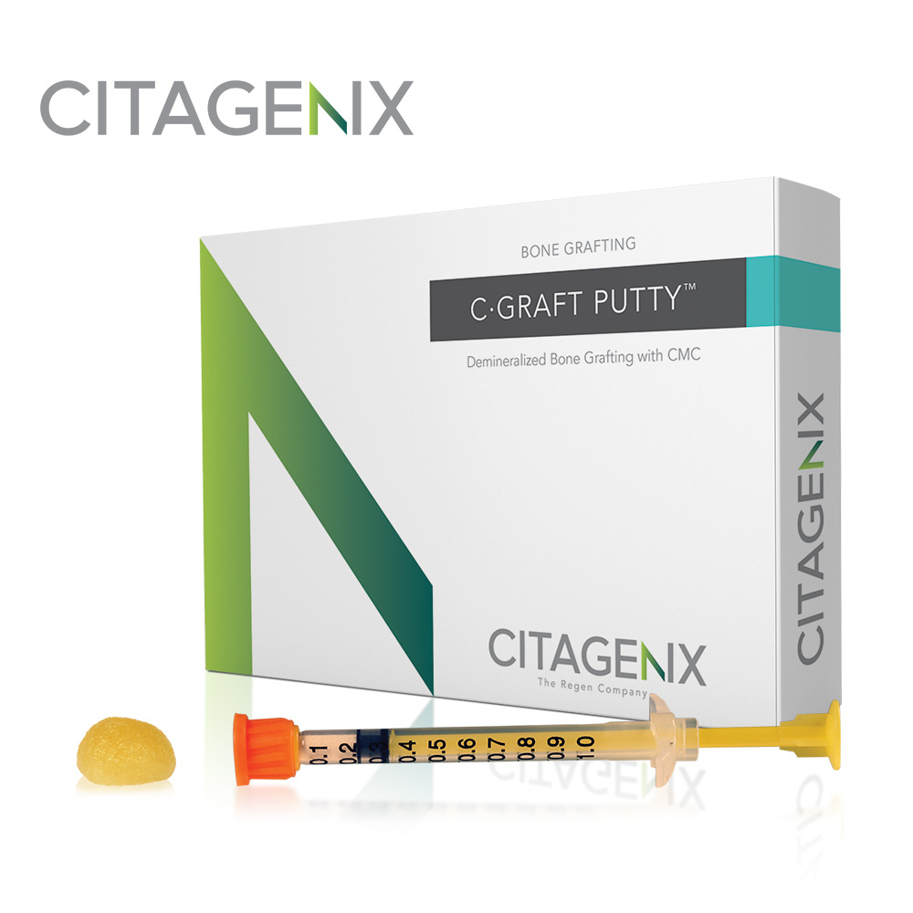 C-Graft Putty�