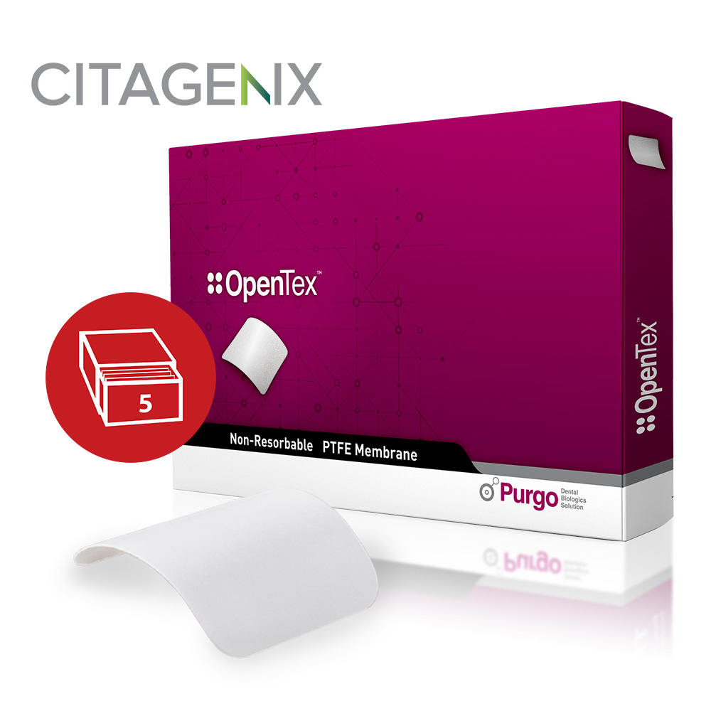 OpenTex�
