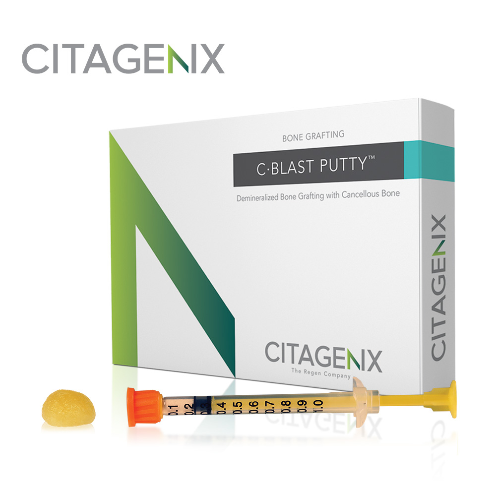 C-Blast Putty�