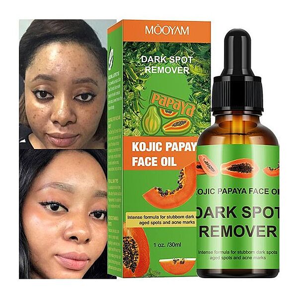KOJIC PAPAYA OIL SPOT REMOVER FOR STUBBORN DARK SPOT & KNUCKLES - 30ML