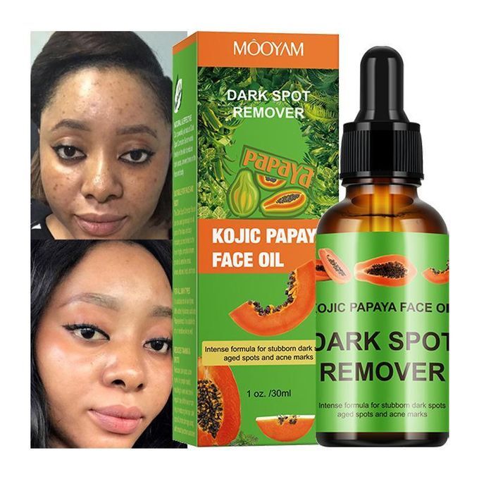 KOJIC PAPAYA OIL SPOT REMOVER FOR STUBBORN DARK SPOT & KNUCKLES - 30ML