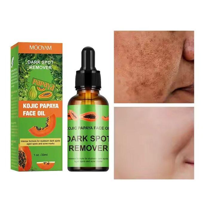 KOJIC PAPAYA OIL SPOT REMOVER FOR STUBBORN DARK SPOT & KNUCKLES - 30ML