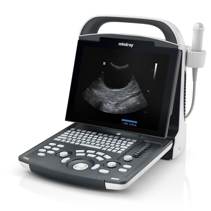 Ultrasonido portatil DP20