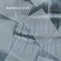 OPG Sleeves