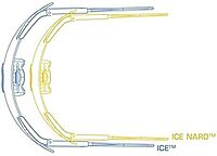 ESS ICE Frame and Nosepiece Kit-Black