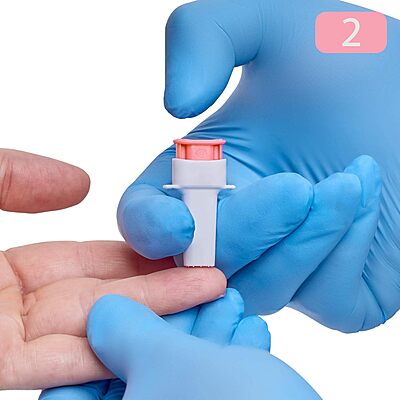 ONE-CARE PRO Safety Lancets Top Button Activated, 28G x 1.5mm, MiniFlow, Pink, 100/bx ONE-CARE PRO Safety Lancets Top Button Activated, 28G x 1.5mm, MiniFlow, Pink, 100/bx