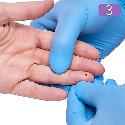 ONE-CARE PRO Safety Lancets Top Button Activated, 30G x 1.2mm, MicroFlow, Purple, 100/bx ONE-CARE PRO Safety Lancets Top Button Activated, 30G x 1.2mm, MicroFlow, Purple, 100/bx