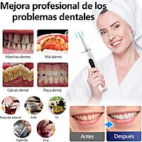 Removedor de sarro dental,removedor de placa dental ultrasónico (mascotas)