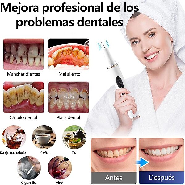 Removedor de sarro dental,removedor de placa dental ultrasónico (mascotas)