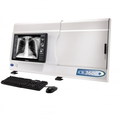 Digitalizador de imágenes RX para radiografía general Digitalizador de imágenes RX para radiografía general