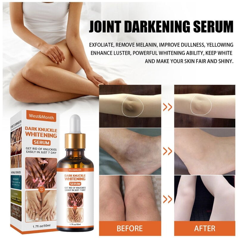 DARK KNUCKLE WHITENING SERUM - 7 DAYS EFFECT  - 50ML
