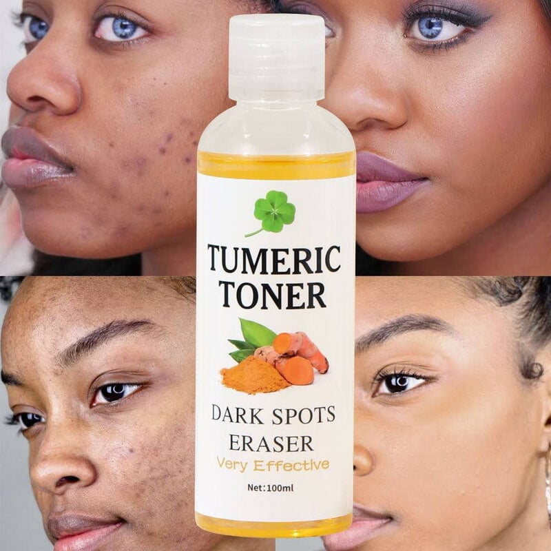 TUMERIC TONER DARK SPOT ERASER - 100ML