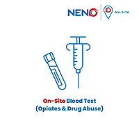 On-Site Blood Test (Opiates & Drug Abuse)