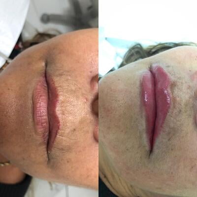 RED ROSE 15ML RED ROSE 15ML