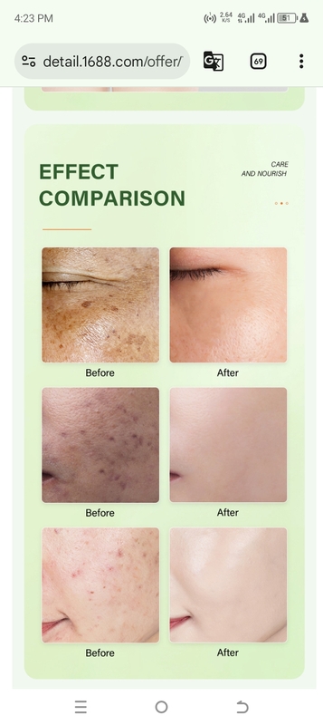 KOJIC PAPAYA OIL SPOT REMOVER FOR STUBBORN DARK SPOT & KNUCKLES - 30ML