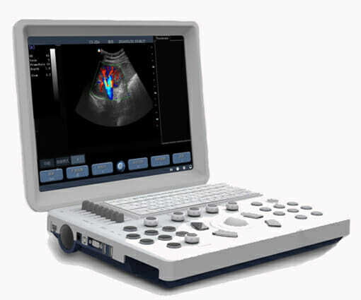 ULTRASONIDO MARSHALL M15 EXPERT DOPPLER COLOR Y PULSADO