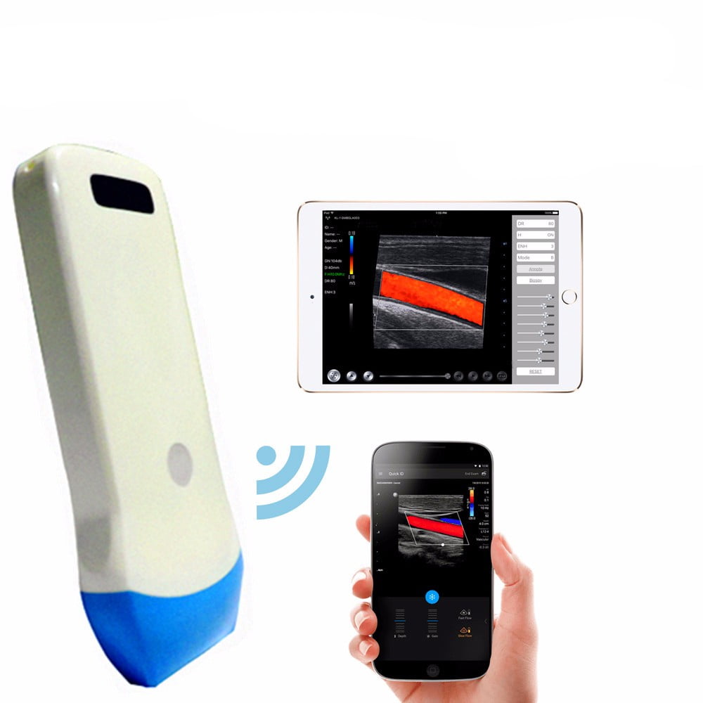 Ultrasonido Freedom Color Doppler Inalámbrico
