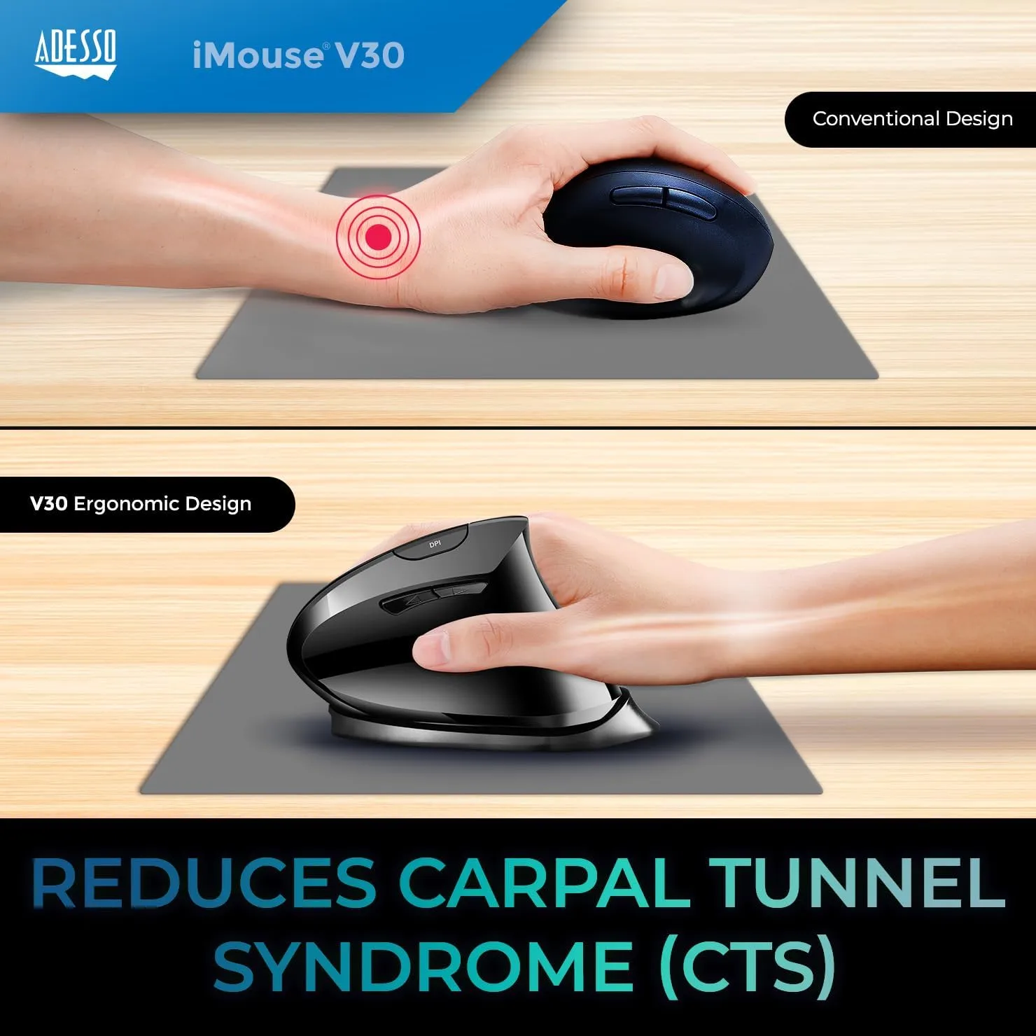 iMouse V30 Wireless Adjustable Vertical Ergonomic Mouse with DPI Switch