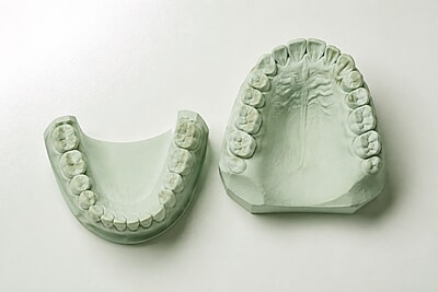 Modelos en Alef V verde, vista oclusal Modelos en Alef V verde, vista oclusal