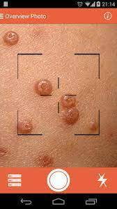 dermatólogo en línea dermatólogo en línea