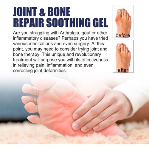 EELHOE JOINT & BONE REAIR SMOOTHING GEL 30ML