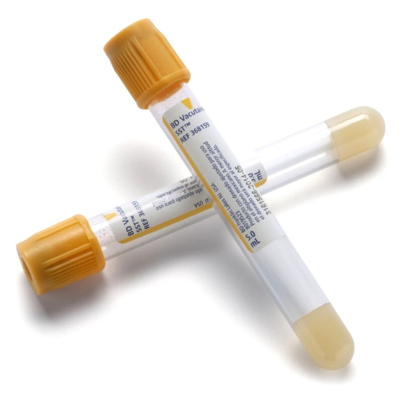 Tubo BD Vacutainer Gel Activador 5 ml 100 Piezas Tubo BD Vacutainer Gel Activador 5 ml 100 Piezas